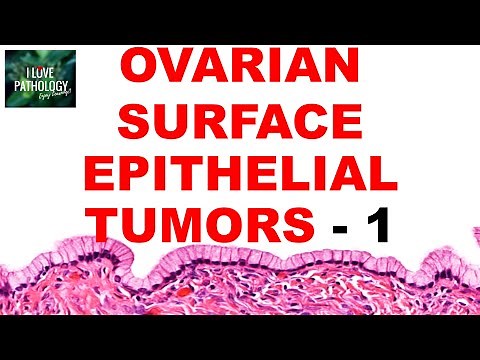 OVARIAN TUMORS - Part 2 : SEROUS AND MUCINOUS TUMORS- Etiopathogenesis and morphology