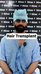 Hair Transplant journey of a Patient |Why is Skinaa the Best for Hair...
