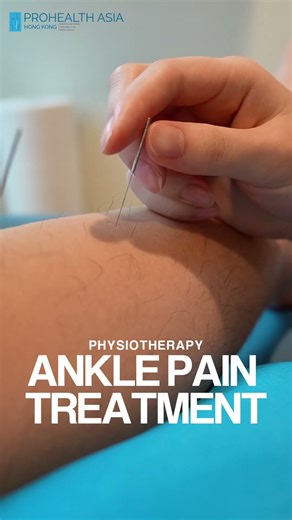 Ankle Treatment Video