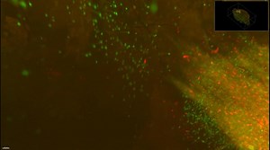 File:Whole-brain-3D-mapping-of-human-neural-transplant-innervation-ncomms14162-s3.ogv - Wikimedia Commons