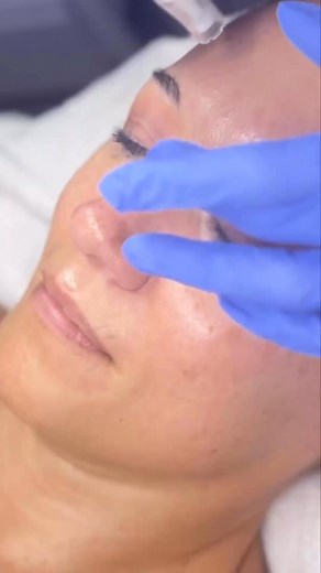 Hey North Scottsdale Ladies! 💕 Not all skin ages the same. For some it’s fine lines, for others its uneven texture or a glow that’s slowly faded. We think everyone deserves to feel confident in their skin! That’s why I created the “Skin Renewal Experience” - designed to hydrate, refresh, and bring out a more youthful glow. Here’s what’s included: ✅Personalized Skin Analysis - We'll assess current skin health, discuss your goals, and create a simple, custom plan tailored to your needs and comfor