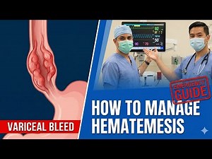 How to Manage Hematemesis and Variceal Bleeding | Step-by-Step Guide