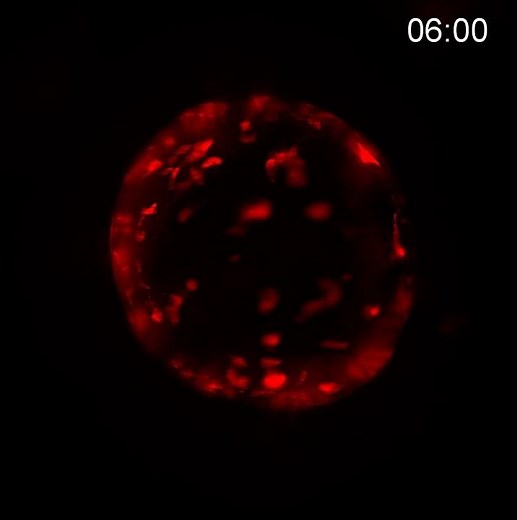 Scientists unravel the key to colon cancer relapse after chemotherapy