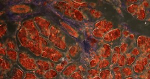 pancreas with islet cells in Darkfield tissue under the microscope 200x