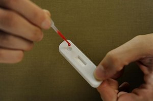 HIV disclosure law to be amended to exempt those with undetectable viral load if conditions are met