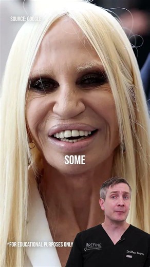 Donatella Versace: Before and After | Dr. Matt Brown.