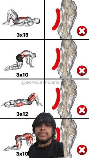 🥷Learn how to fix sway back with these effective exercises and tips! This video guides you through🏋️