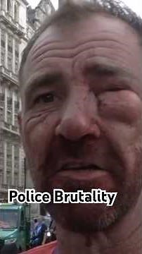 POLICE BRUTALITY MAN GETS BEAT UP & BLOOD EVERYWHERE! #2025 #wow #london #god #protest # #story 🙏🏻