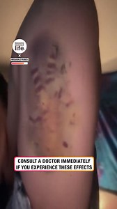 Consult a doctor immediately if this happens to you 😳 | Lessons Learned In Life