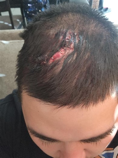 Las Vegas father comes forward after Spy Ninjas accident