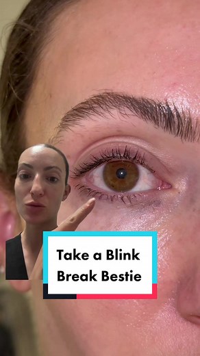 Replying to @peggisue89 take a blink break bestie! #dryeye #dryeyedisease #screens #digitaldevice #digitaleyestrain #blink