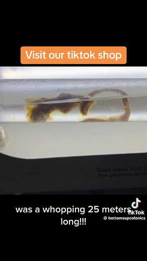 Parasite Cleanse: Removing Intestinal Worms for Better Health