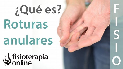 Roturas anulares o del anillo fibroso discal. ¿Qué es?
