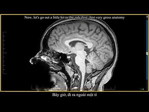 1. Brain MRI Anatomy: Introduction