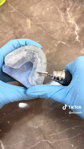 Michigan Tanner Splint for Jaw Joint Relief