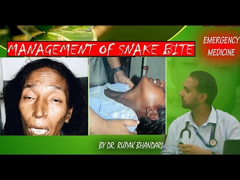 Emergency Medicine | Management of Snake Bite | Dr. Rupak Bhandari