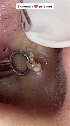 Nose Care Routine: Removing Lotion or Cream Effectively