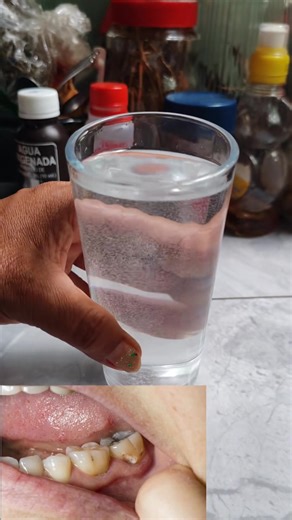 Dolor de muela | Divina MUJER