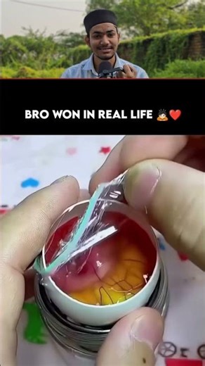 Chidiya Ke Bachhe Ko Nayi Zindagi Dedi #shorts