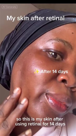 what is Retinal? All you need to know about Retinal! - Retinal is the next form of Retinol and works 11 times faster on the skin. - Retinal promotes skin cell turnover to prevent signs of aging - Retinal is more gentle than traditional retinol, making it suitable for sensitive skin. @KSECRET GLOBAL #glowshotchallenge #ksecret #seoul1988 #retinal