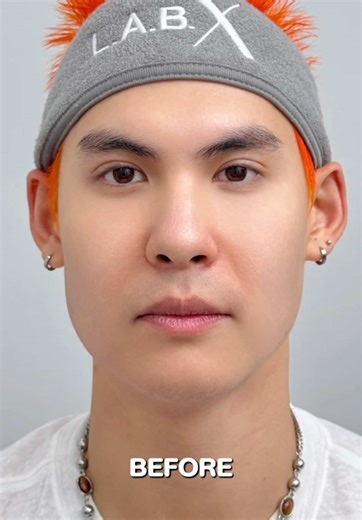 Here are the results of the Ulthera Prime Treatment! 😱 #LABXClinic #LABXReview #LABXInter #ultherapy #ultheraprime #ulthera