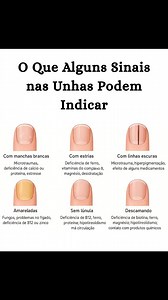💅🌿 O Que Alguns Sinais nas Unhas Podem Indicar 🌿💅 1️⃣ Manchas brancas Podem aparecer após pequenos traumas ou por carência de cálcio, proteína ou estresse acumulado. 2️⃣ Estrias Relacionadas à deficiência de ferro, vitaminas do complexo B, magnésio ou desidratação. 3️⃣ Linhas escuras Associadas a microtraumas, hiperpigmentação ou efeito de determinados medicamentos. 4️⃣ Unhas amareladas Podem surgir por fungos, questões hepáticas ou falta de vitaminas como B12 e zinco. 5️⃣ Sem lúnula Indica 
