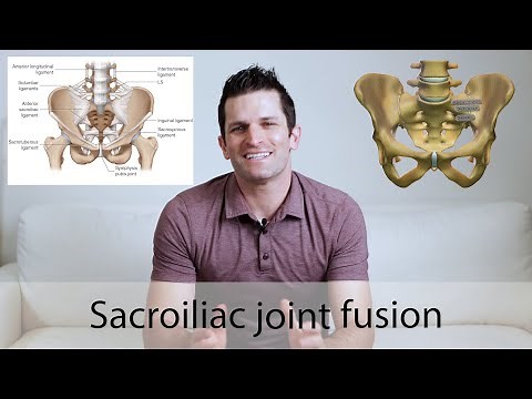 Sacroiliac joint fusion surgery