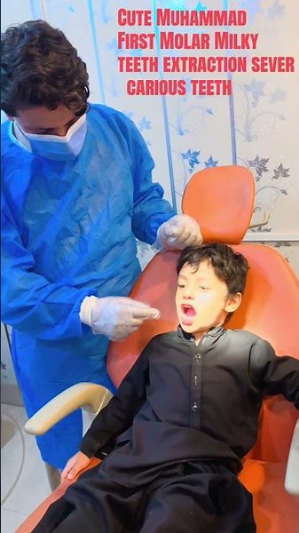 Baby Tooth Molar Extraction 🦷👶 | Safe & Simple Dental Procedure #babyteeth #MolarExtraction