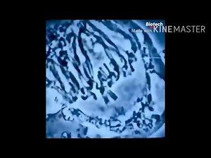 Meiosis under the microscope💙