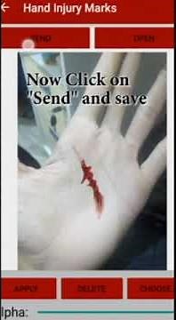 Create fake Injury marks in Photo