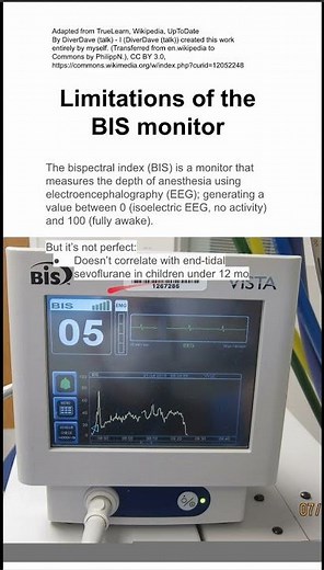 Limitations of the BIS monitor