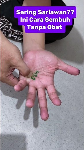 Sering Sariawan di Lidah?? Ini Cara Sembuh Tanpa Obat! 👅