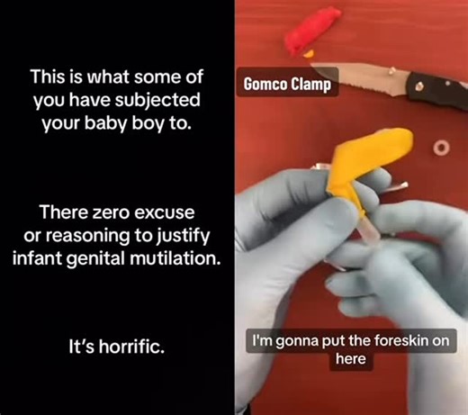 Victoria Nichole Doula 🍒 | #momlife #momsofinstagram #babyboy #boymom #circumcision #intactivist #viral | Instagram