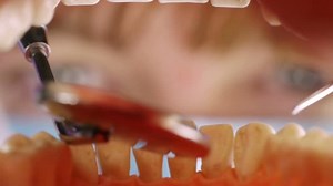 Teeth Work Inside Mouth Hd Dentist Stock Footage Video (100% Royalty-free) 2320586 | Shutterstock