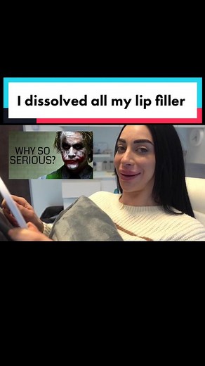 Dissolving lip filler sure ain’t as pretty as a getting filler done 😅. Just keepin it 💯 😉 #lipfiller #hyaluronidase #fyp #viral #realtalk #beauty
