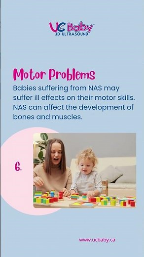 Understanding Neonatal Abstinence Syndrome (NAS) Complications | UC Baby