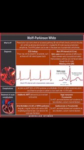 437 reactions · 6 comments | ⚠️Wolff-Parkinson-White (WPW) Syndrome: Figure: ECG revealing WPW’s signature trio—short PR interval, delta wave, widened QRS. #WPW #ECG #Cardiology #HeartRhythm | Abdallah Othman | Facebook