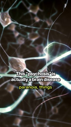 #UofUHealth is leading a nationwide clinical trial for NMDA receptor encephalitis - the rare brain disorder featured in the bestseller "Brain on Fire." This autoimmune condition can strike healthy young people overnight, causing confusion, seizures, and symptoms mimicking psychiatric disorders. The study will test whether the drug, inebilizumab, can effectively target the immune cells attacking the brain, potentially offering hope to patients who currently face uncertain outcomes. Learn more: ht
