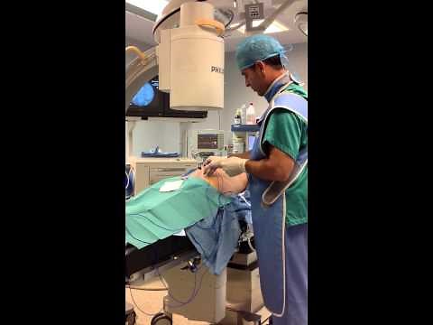 Rizolisis