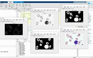 基于Matlab细胞分割、细胞计数、形状分类