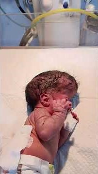 Spina Bifida Awareness for Parents | What Every Mother Must Know During Pregnancy