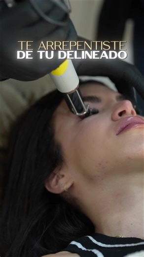 Eyeliners removal Miami 📍📍 #tattooremovalspecialists #tattooremovalprocess #miamitattooremoval