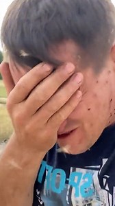 My skin is crawling 🦟😰 | LADbible Australia