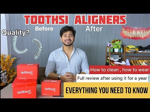 Toothsi Aligners Review And Unboxing (1 year experience) | Everthing you need to know #1