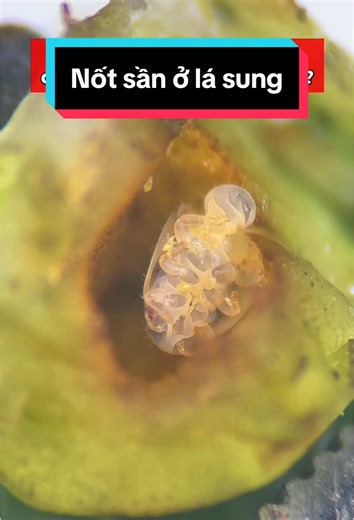 Nốt sần trên lá sung: Khám phá bằng kính hiển vi