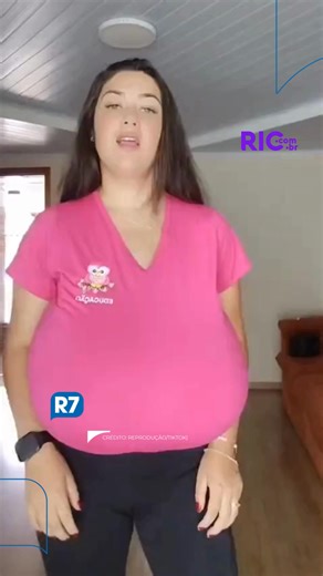 A jovem Thaynara Marcondes, de 22 anos, de Mandirituba, na Região Metropolitana de Curitiba, repercutiu nas redes sociais após relatar que sofria hipertrofia mamária. A doença rara também é popularmente chamada de gigantomastia. Thaynara conta que chegou a ter 12 kg de seios e sentia muitas dores, principalmente nas costas devido ao peso. Logo depois da repercussão do caso, a jovem conseguiu realizar uma mastectomia. Com a cirurgia, foram retirados 10 kg de seios de Thaynara. ➡️ Com informações 