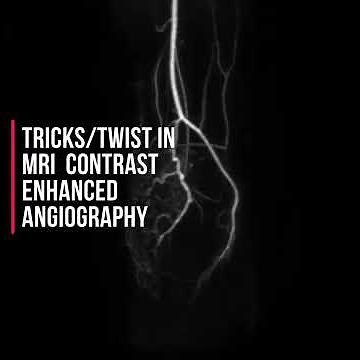 Tricks/Twist MRI Contrast Enhanced Angiography || Radiologicalscience