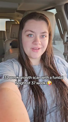 32 Week Growth Scan: What to Expect During Pregnancy
