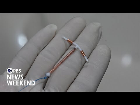 Why IUD insertions are painful for many patients and what can be done better