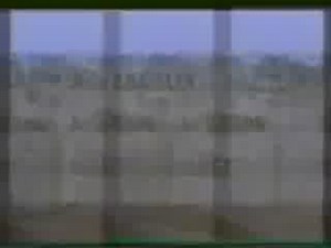 Enucléation de l'adénome prostatique par laser et résection conventionnelle | Canal U